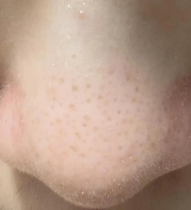 만족
