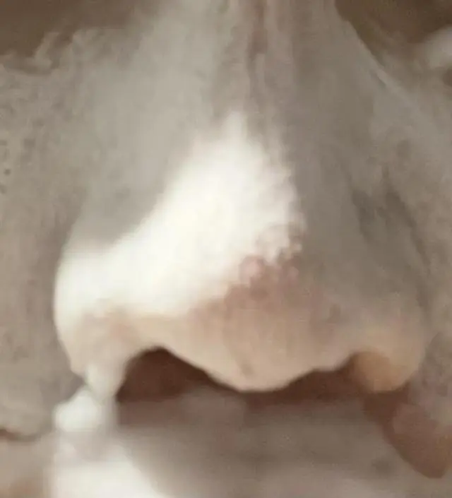 15일꾸준하게 사용해보고 작성합니다 좁쌀여드름 이점차 사라지는 마법 !!!  매일꾸준하