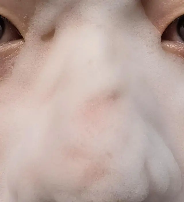 이 제품을 접하기 전까지 수없이 많은 블랙헤드 제거&완화 되는 타 제품들을 많이 