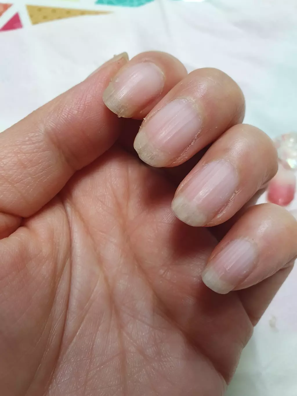 10일지나니 손톱에 머리카락이 살짝씩 껴서
